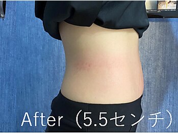 カナウ(kanau)/トリプルボディシェイプ