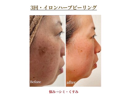 ナトゥーラ(NatuLa)の写真