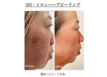 ナトゥーラ(NatuLa)