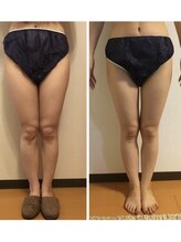 リラココ(リラcoco)/美脚リンパでセルライトケア