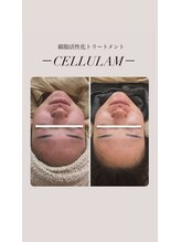 リバイセリー(Revicelly)/比較写真