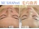 ロージースマイル(Rosy smile)の写真/黒ずみ・詰まりごっそり除去！透明肌へ♪ 【ハイドラ美容液毛穴洗浄】【韓国発　XE`LHAPeel (セラピール】
