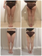 美人バスト 名古屋店/【痩身・ダイエット】 名古屋/脚