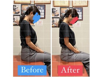 ナオル整体 宮崎院(NAORU整体)/20代女性施術事例【頚部屈曲痛】