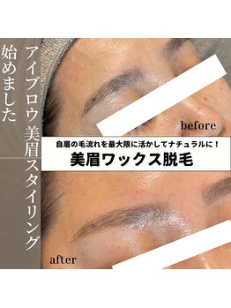 フルールスレーヌ(Fleur Sereine)/美眉ワックス脱毛