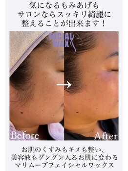 エリス(ELISSE)/もみあげも整えることが出来ます