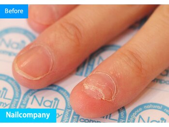 ネイルカンパニー/