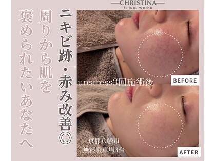 エイム(eim)の写真