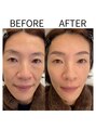 ミルク(MILK) 骨格に合わせた美眉Waxでナチュラルなのに洗練された印象に