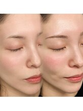 ウル(Ulu.)/自眉の可能性を最大限に引き出す