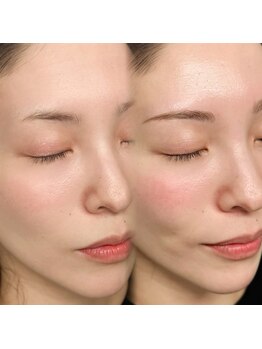 ウル(Ulu.)/自眉の可能性を最大限に引き出す