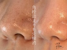 フレキシ 表参道(Flexi)の雰囲気(毛穴の詰まりや開きにはハーブピーリングの酸と保湿力が必須◎)