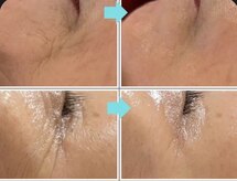 ピーチ ローズ(peach rose)