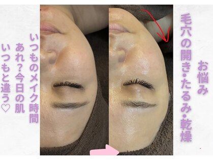 ニース(NICE)の写真