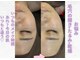 ニース(NICE)の写真