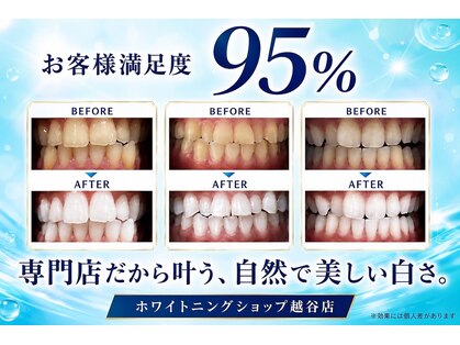 ホワイトニングショップ 越谷店の写真