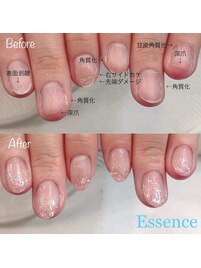 美爪育成ジェルスカルプ