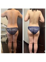 リラクゼーションサロンネロリ/くびれ出し！インディバ+リンパ