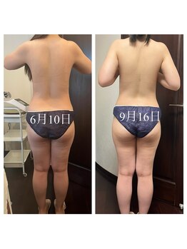 リラクゼーションサロンネロリ/くびれ出し！インディバ+リンパ