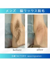 ビー ファクトリー(B FACTORY)/男性のワキ毛もスッキリ！