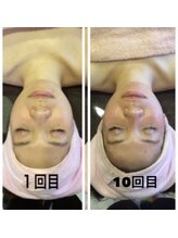 小顔 ツヤ肌/小顔コルギ