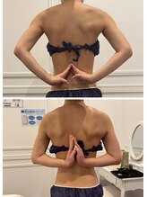 心斎橋 ルヴィ(REVI)/ボディ/痩身エステ/ダイエット