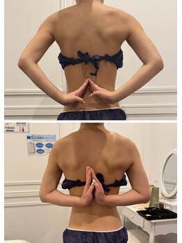 心斎橋 ルヴィ(REVI)/ボディ/痩身エステ/ダイエット