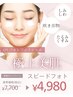 【照射のみ】IPLスピードフォト☆顔脱毛込　通常7700円→4980円