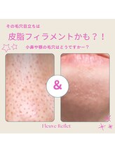 フルーヴ ルフレ(Fleuve Reflet)/毛穴づまり？それとも…
