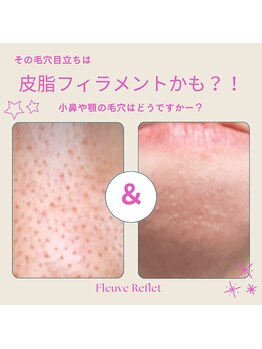 フルーヴ ルフレ(Fleuve Reflet)/毛穴づまり？それとも…