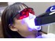 ヴィヴィ(ViVi)の写真/最先端マシン導入！セルフホワイトニングで驚きと感動のビフォーアフター体験を☆