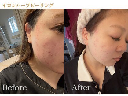 ナトゥーラ(NatuLa)の写真