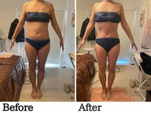 アヤ(Aya)/痩身90分1回のビフォーアフター