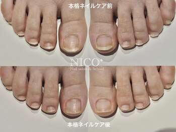 ニコプラス(NICO+)/爪育ネイルケア