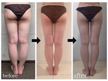 美人バスト 名古屋店/【痩身・ダイエット】 名古屋/脚