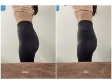 バニーヒップ(Bunny Hip)/before→after