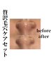【顔脱毛】美肌顔脱毛+毛穴吸引(角栓/黒ずみ/毛穴汚れ除去)￥4400！