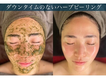 アリィ(Alii hisaya)の写真