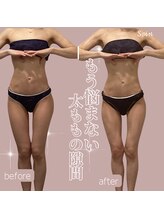 ソワン(Soin)/30代　太もも