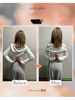 ヴィオラプラス(violla Plus+)/巻肩矯正