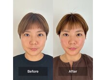 ハリオン 中目黒(HARI-ON)の雰囲気（東洋医学×西洋医学を組み合わせた効果重視の施術○）