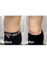 ドクターエイジレス(DR.AGELESS)/健康診断で引っかかった方注目！