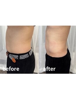 ドクターエイジレス(DR.AGELESS)/健康診断で引っかかった方注目!