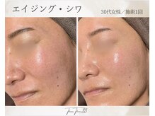 スリースリー(THREE THREE)/エイジング・しわケア