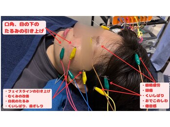 フラット柏(FLAT柏)/【美容鍼】小顔・毛穴ケアに最適