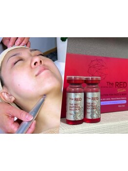 ホウレイ線・たるみ改善！予防ケア