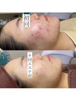 エクラリール(eclat rire)/お客様ビフォーアフター