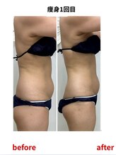 ステラ(Stella)/1回でここまで変化