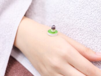 ぬまた鍼灸院/お灸