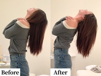 ソレア(Solea)/首こり改善1回目